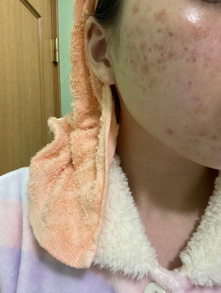 モイスチャー リッチローション(とてもしっとり)/アルージェ/化粧水を使ったクチコミ(1枚目)