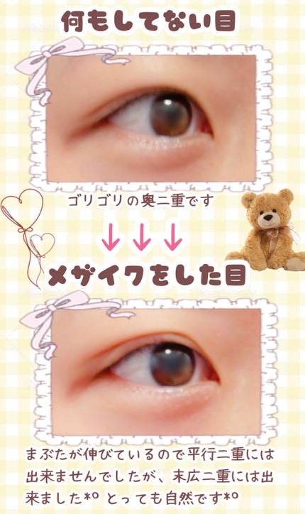 ストリングファイバー120 ディープタイプ/メザイク/二重まぶた用アイテムを使ったクチコミ(2枚目)