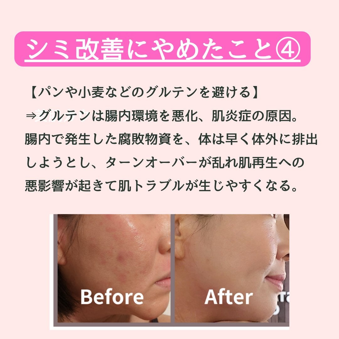 美肌カウンセラー💆肌悩みを解決し見る世界を変える on LIPS 「肌を綺麗にする専門家💆肌荒れ難民族だったわたしが"シミ改善のた..」(6枚目)