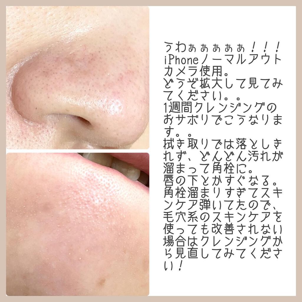 デュオ ザ クレンジングバーム ホワイトa/DUO/クレンジングバームを使ったクチコミ（2枚目）