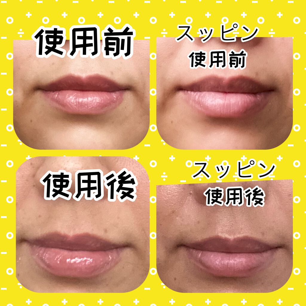 プルプルリップ/ピュレア/リップスクラブを使ったクチコミ(5枚目)
