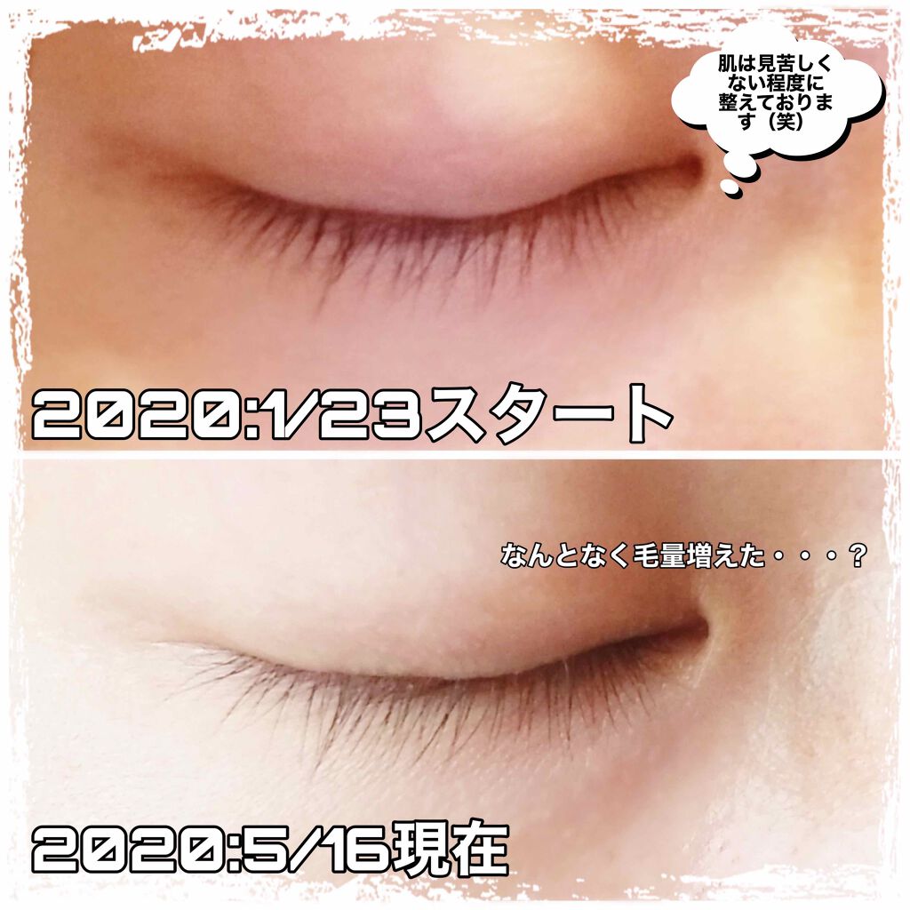 スカルプD ボーテ ピュアフリーアイラッシュセラム/アンファー(スカルプD)/まつげ美容液を使ったクチコミ(2枚目)