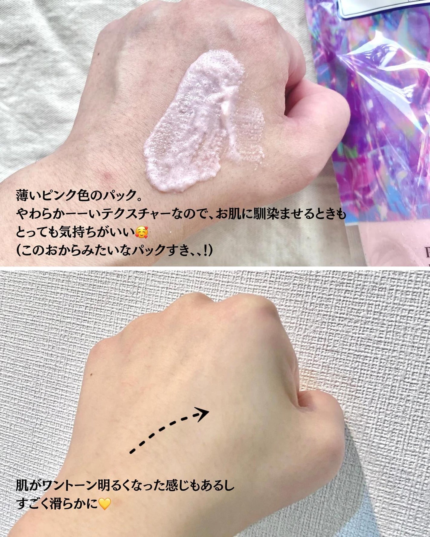 ピンクティーツリーライスシカウォッシュオフパック/APLIN/洗い流すパック・マスクを使ったクチコミ(4枚目)