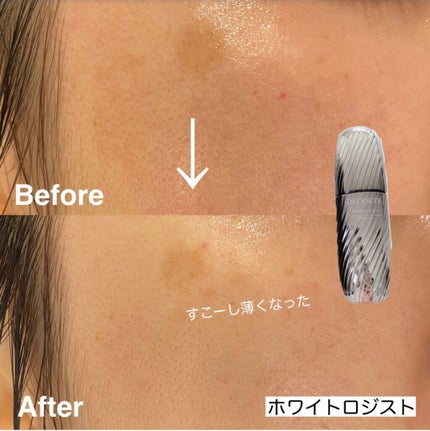 メラノフォーカスV/HAKU/美容液を使ったクチコミ(4枚目)