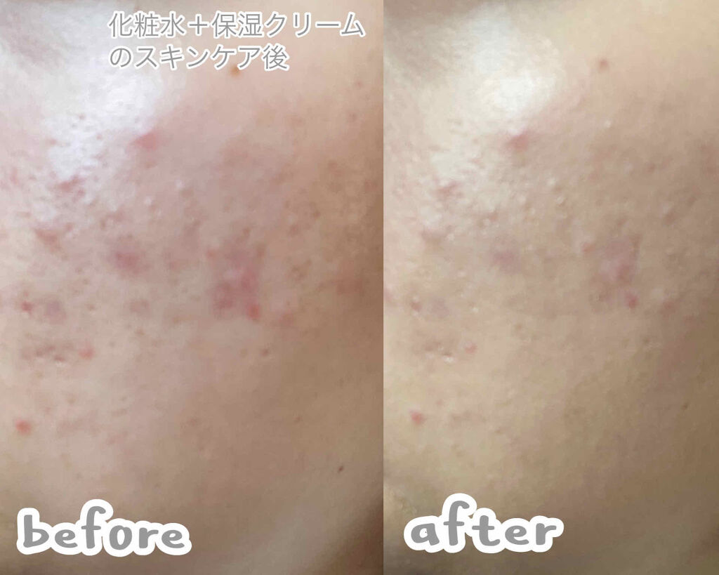 ドクタージャルト シカペア リカバー (第2世代）/Dr.Jart＋/フェイスクリームを使ったクチコミ（3枚目）