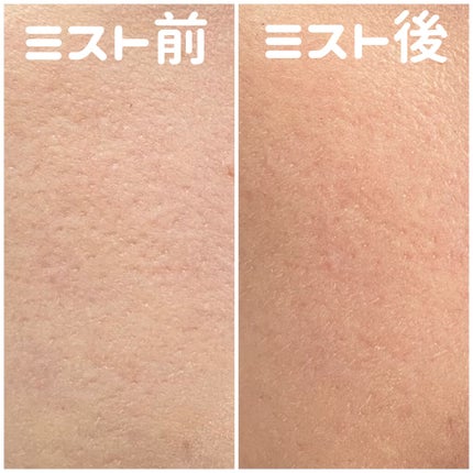 ãã©ããã£ãã¯ãã¹ã EX/ããã¢ãŒãžã¥/ãã¹ãç¶åç²§æ°Žã䜿ã£ãã¯ãã³ãïŒ6æç®ïŒ