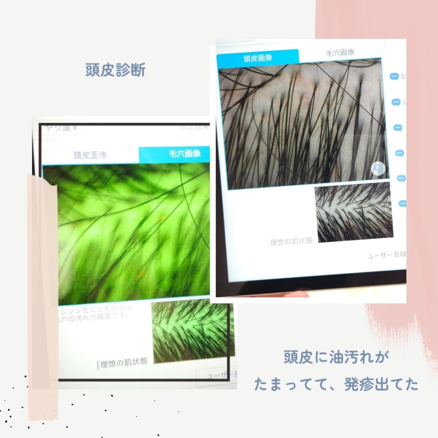 リファ ハートブラシ/ReFa/頭皮ケアを使ったクチコミ(2枚目)