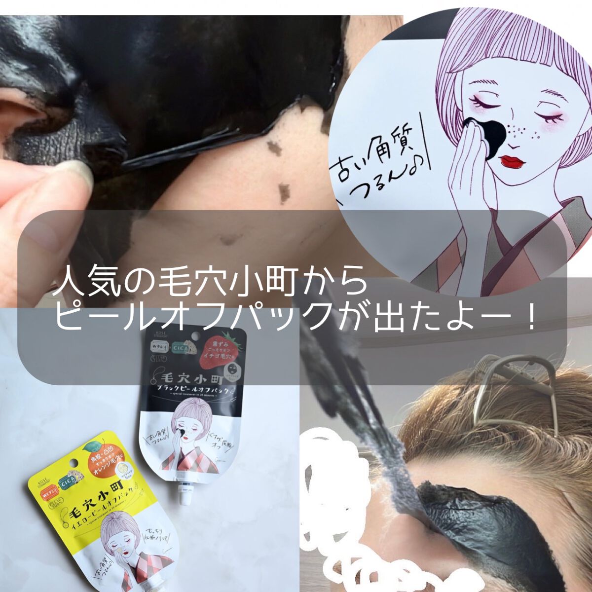 毛穴小町 ブラックピールオフパック/クリアターン/ピーリングを使ったクチコミ（1枚目）