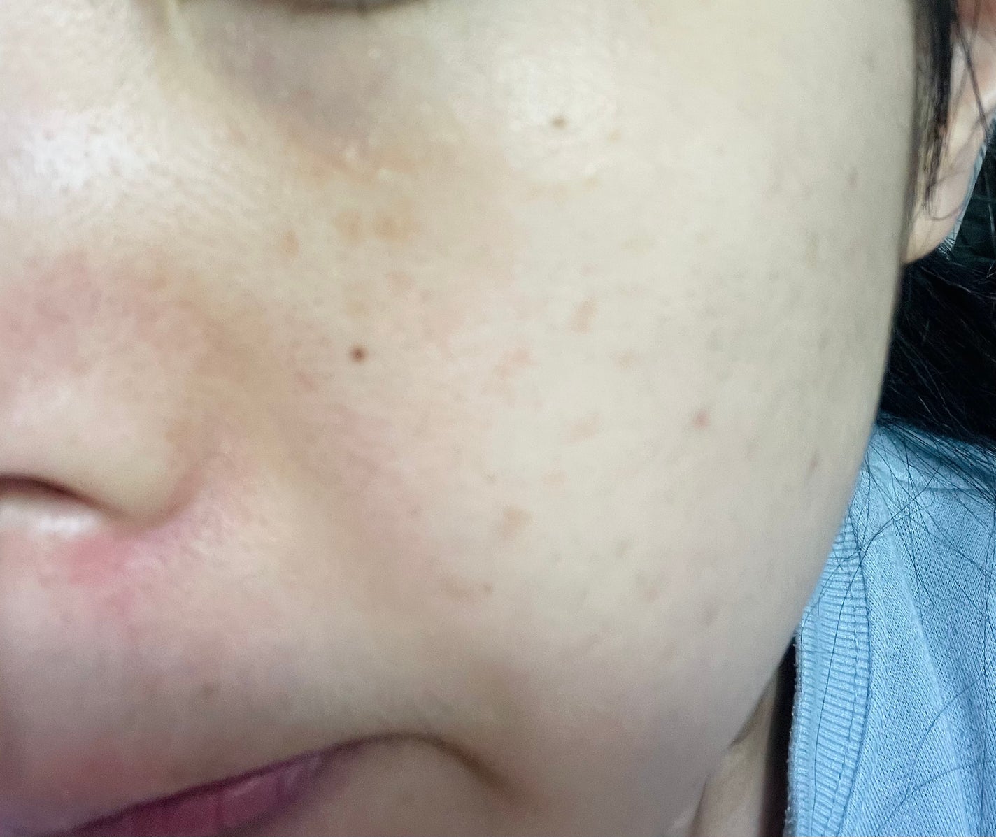 レチノール スーパーバウンス セラム/IOPE/美容液を使ったクチコミ(4枚目)