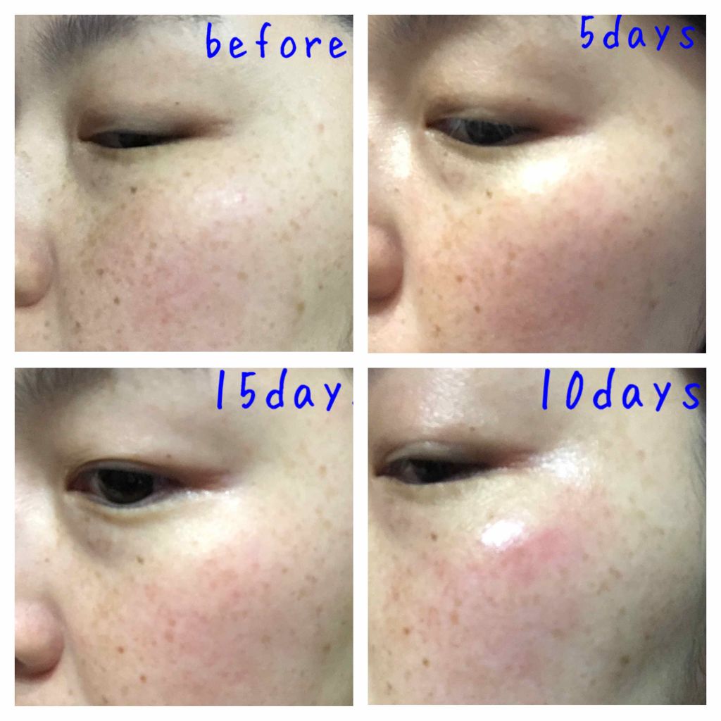 ホワイト 薬用ドットゼロ/リッツ/美容液を使ったクチコミ（3枚目）