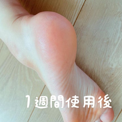 カカトリーヌモイストローション/KAKATOrine/レッグ・フットケアを使ったクチコミ(5枚目)