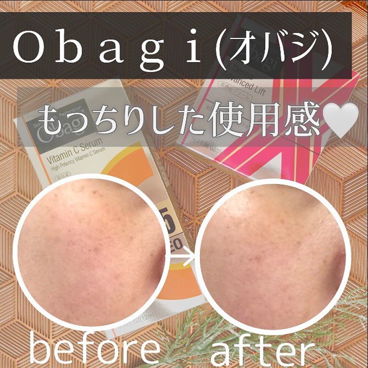 C25セラム ネオ/オバジ/美容液を使ったクチコミ(6枚目)