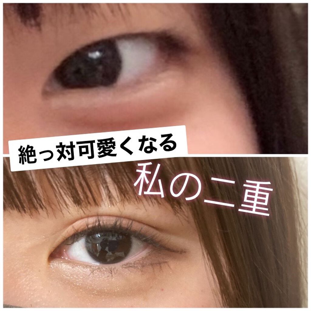 のびーるアイテープ（絆創膏タイプ、レギュラー）/DAISO/二重まぶた用アイテムを使ったクチコミ（1枚目）