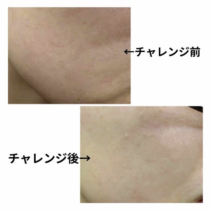 ツボクサ化粧水/ONE THING/化粧水を使ったクチコミ(3枚目)