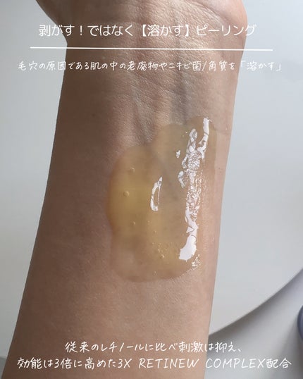 トリプル レチノール ウォッシュピール/Celladix/ピーリングを使ったクチコミ(3枚目)