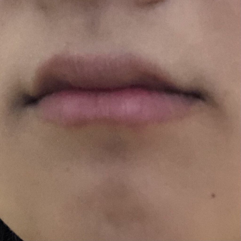 38°C / 99°F リップトリートメント (リップ美容液)/UZU BY FLOWFUSHI/リップケアを使ったクチコミ（2枚目）