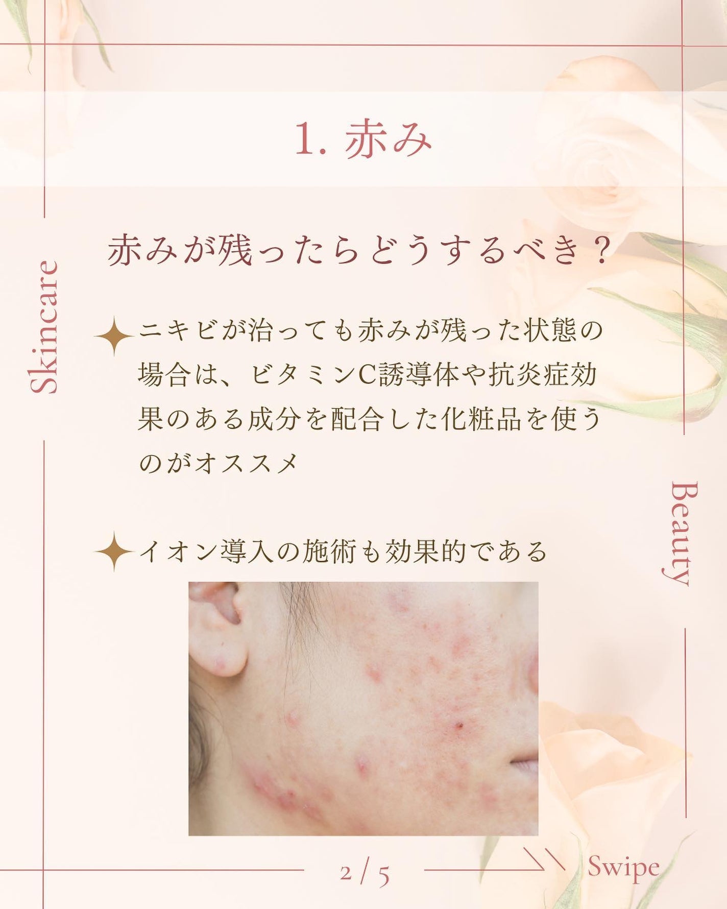 ã¿ãð¹ on LIPS ãæå€ãšç¥ããªã/ãããè·¡ã®ãæå
¥ãæ¹æ³ð¡ãããè·¡ãæ¹åãããã..ãïŒ3æç®ïŒ