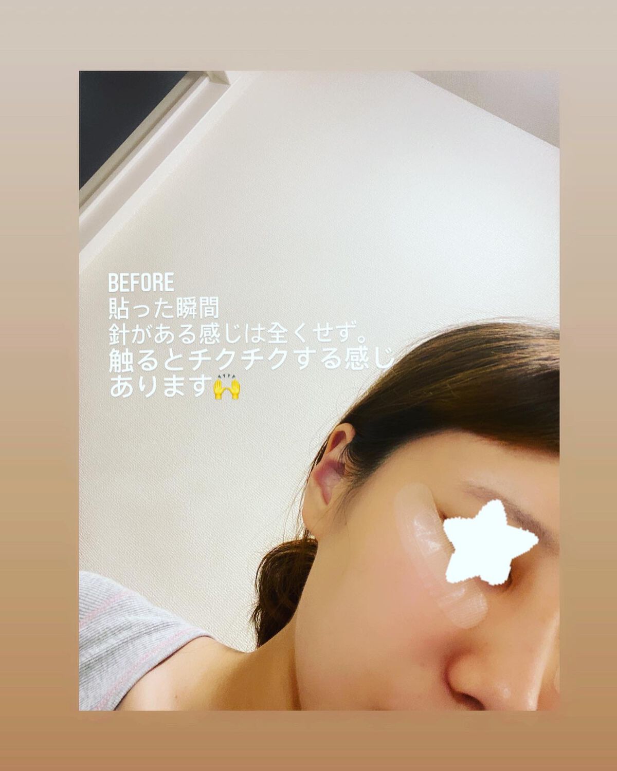 クリアターン ヒアロチューン マイクロパッチ 1500/クリアターン/シートマスク・パックを使ったクチコミ（3枚目）