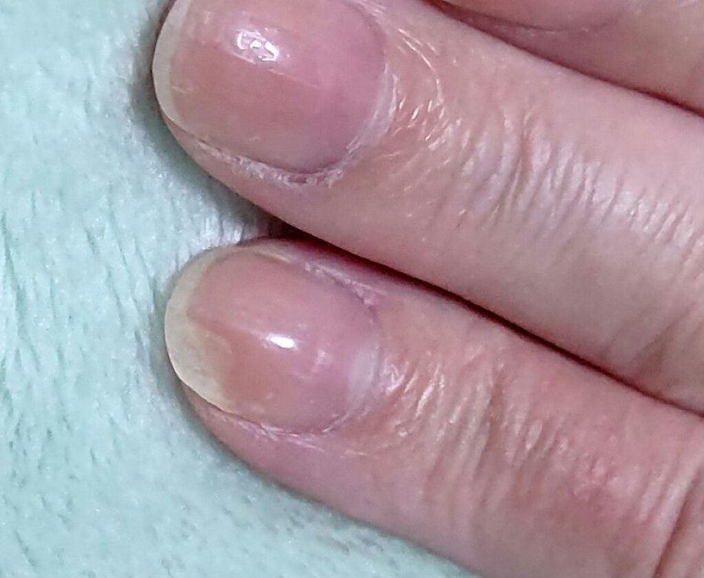 ハンドベール プレミアムリッチネイル/メンソレータム/ネイルオイル・トリートメントを使ったクチコミ(1枚目)