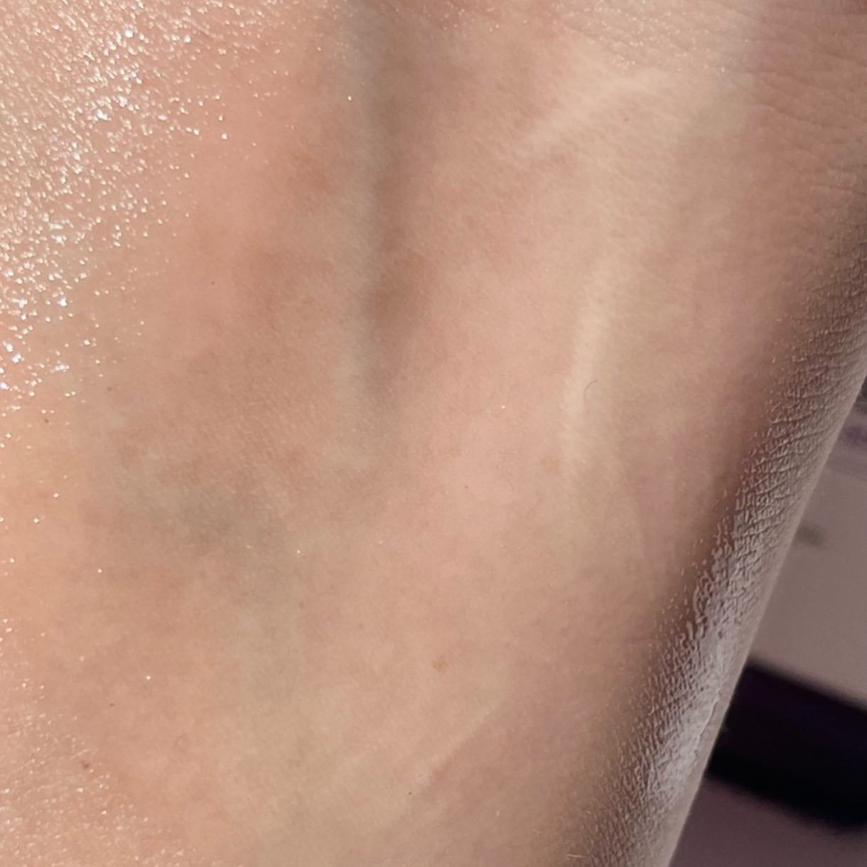 レチノールインテンスリアクティベーションセラム/SOME BY MI/美容液を使ったクチコミ(4枚目)