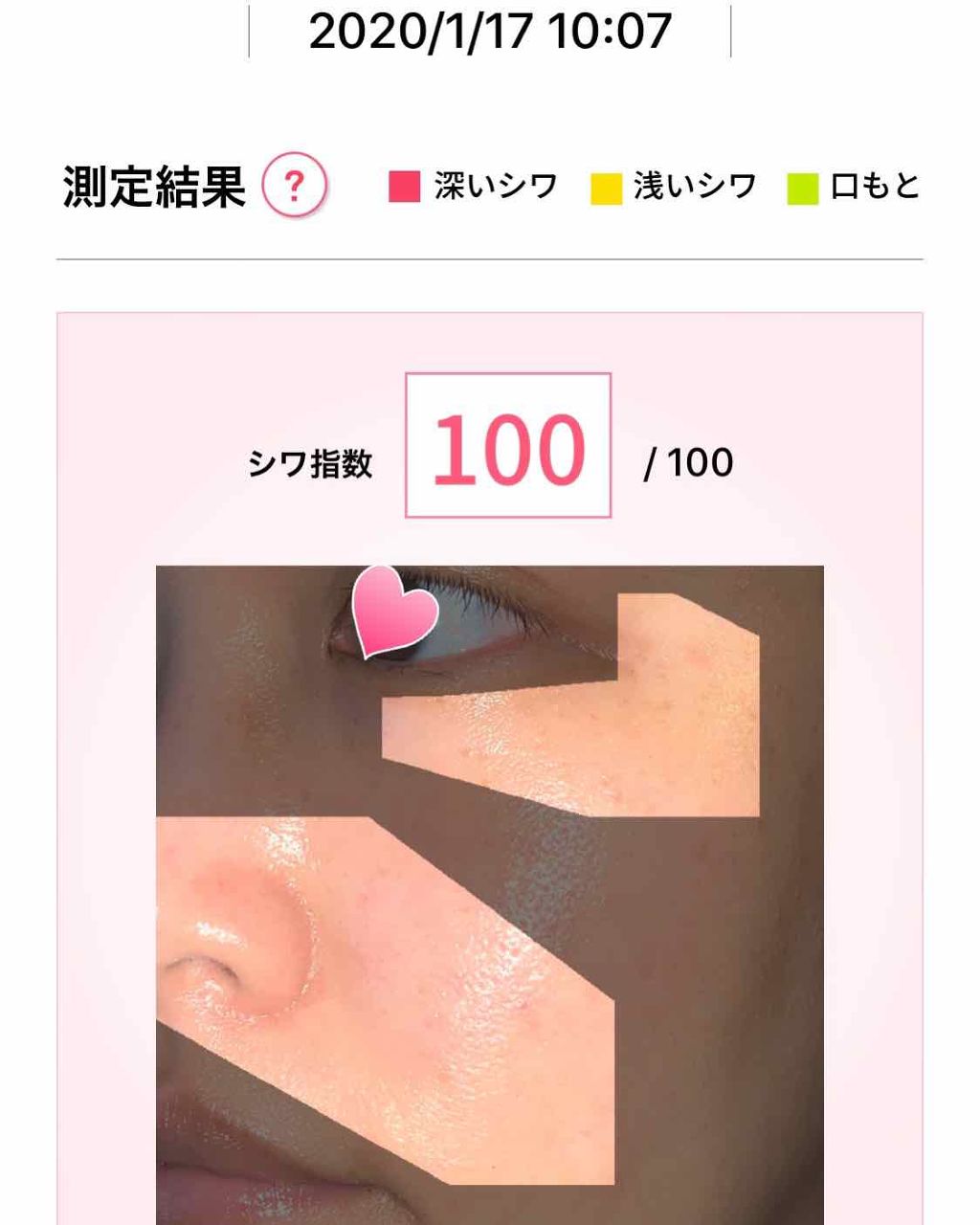 リンクルホワイトエッセンス/オルビス/美容液を使ったクチコミ(2枚目)