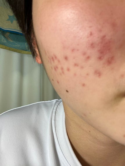 を使ったクチコミ(2枚目)