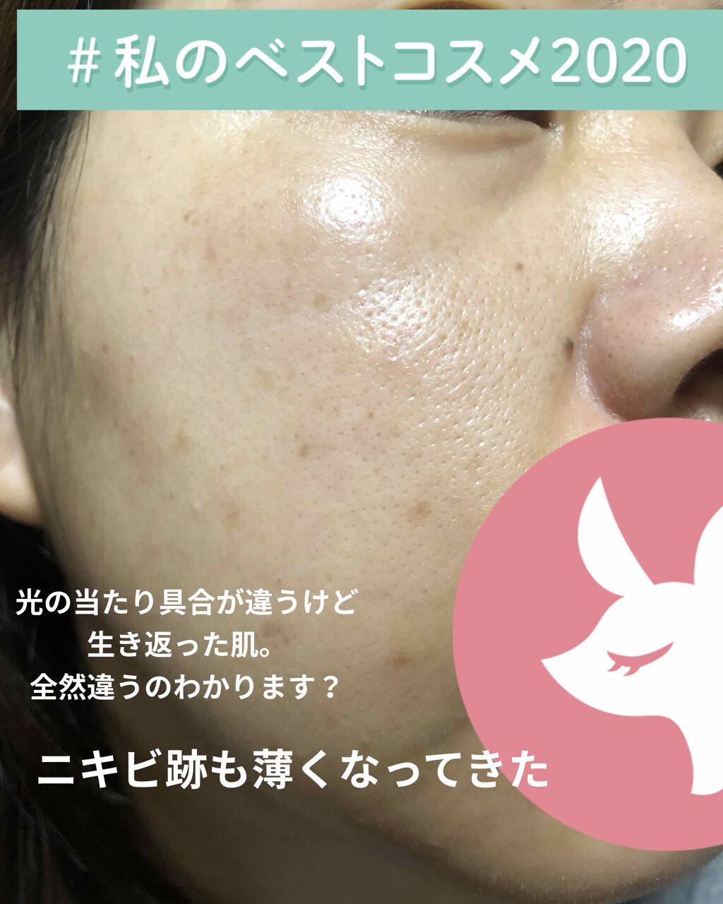 アクティブベース クリアウォッシュ/オバジ/洗顔フォームを使ったクチコミ(1枚目)