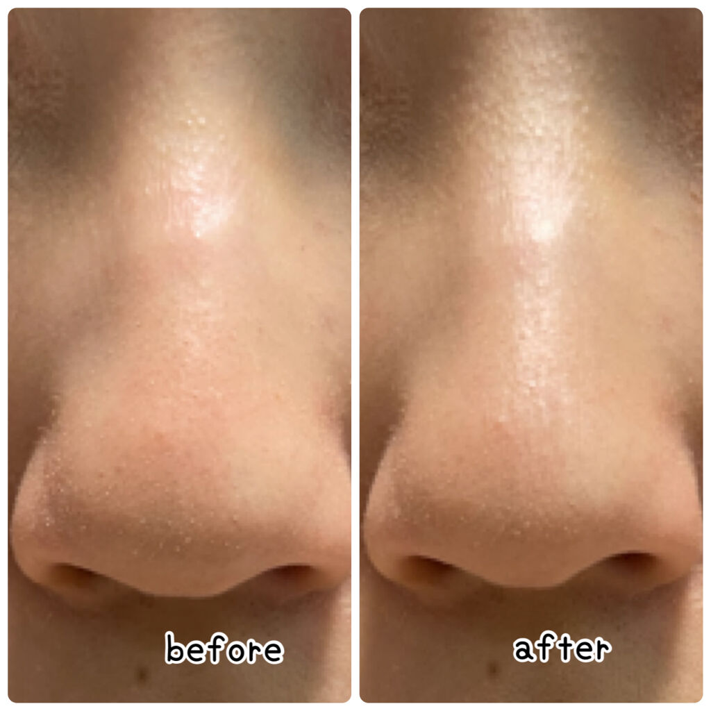 スリムノーズメイククリエイター/KATE/シェーディングを使ったクチコミ（2枚目）