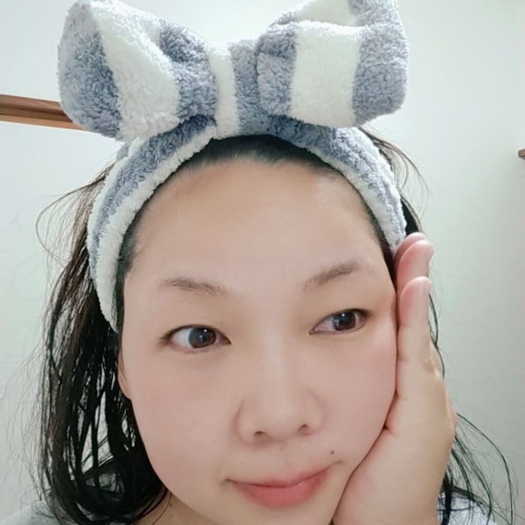 バイオイル/バイオイル/フェイスオイルを使ったクチコミ(5枚目)