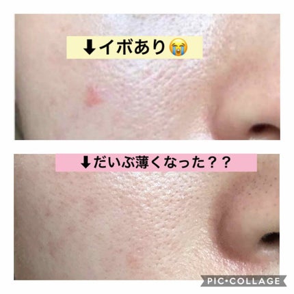 敏感肌用薬用美白美容液/無印良品/美容液を使ったクチコミ(3枚目)