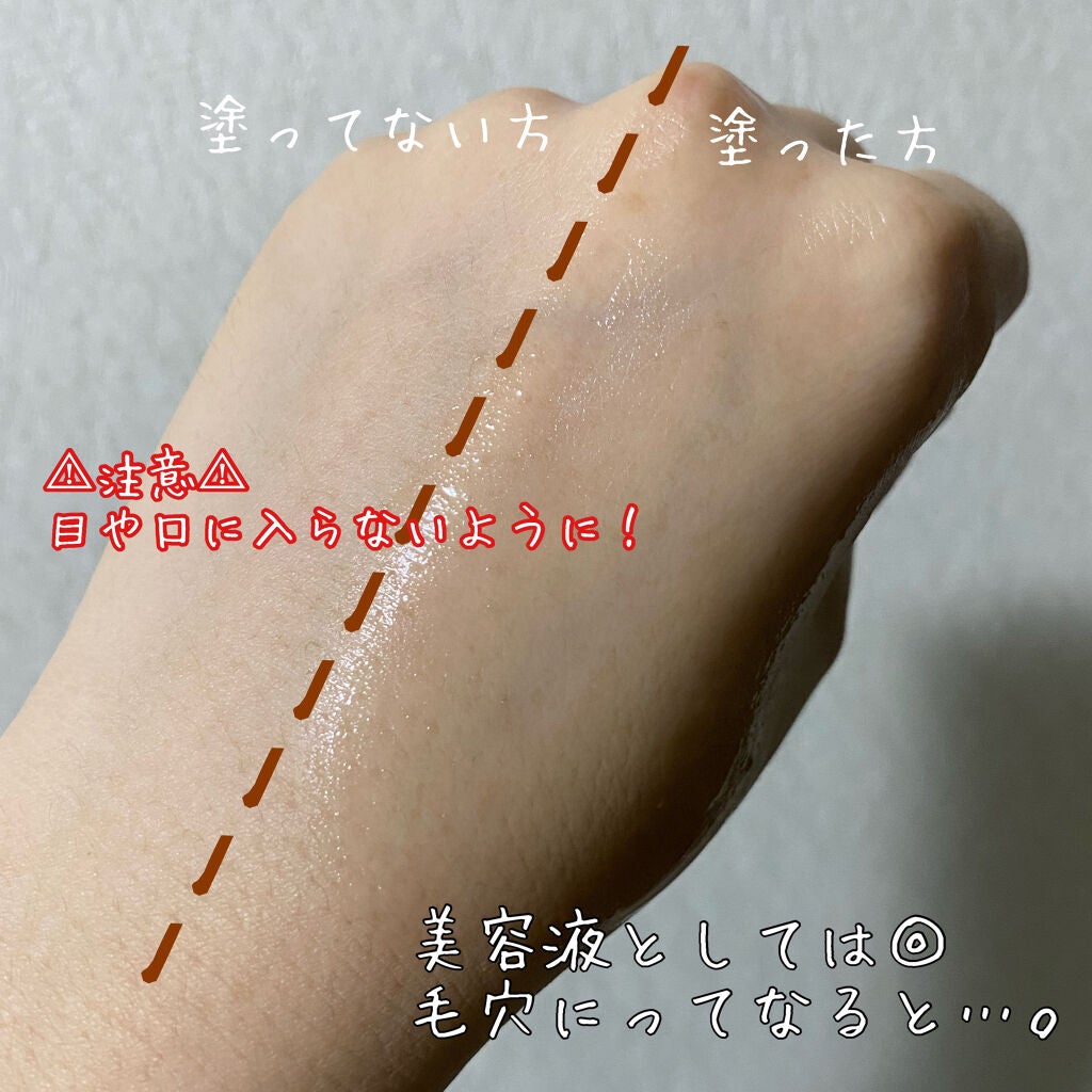 スーパー毛穴ピールセラム/ラボラボ/美容液を使ったクチコミ(3枚目)