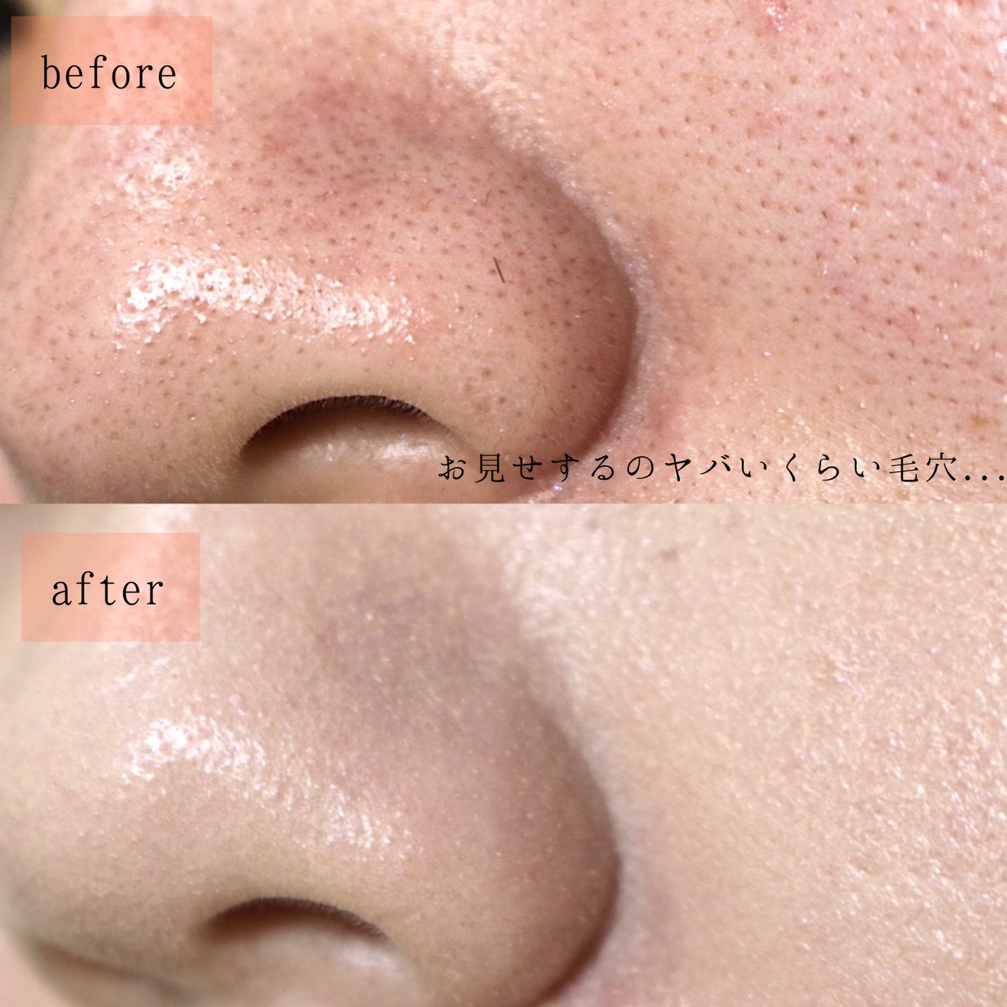 ピンクティーツリーカバーアップグロウクッション/APLIN/クッションファンデーションを使ったクチコミ(6枚目)