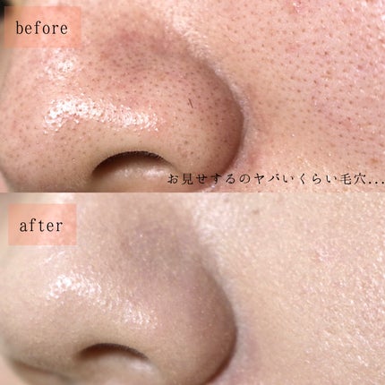 ピンクティーツリーカバーアップグロウクッション/APLIN/クッションファンデーションを使ったクチコミ(6枚目)