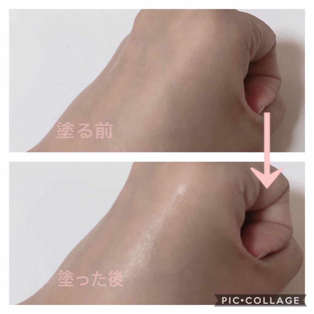 ペアアクネクリームW(医薬品)/ペア/その他を使ったクチコミ（2枚目）