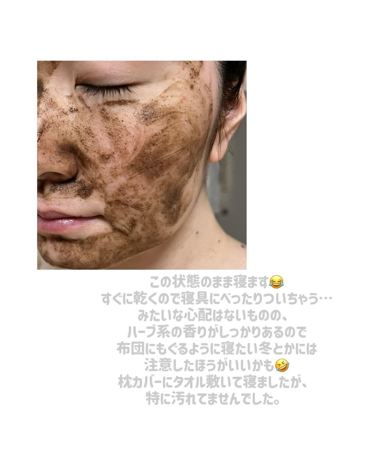 ダーマスキンピーリング/BQCELL/その他キットセットを使ったクチコミ（3枚目）