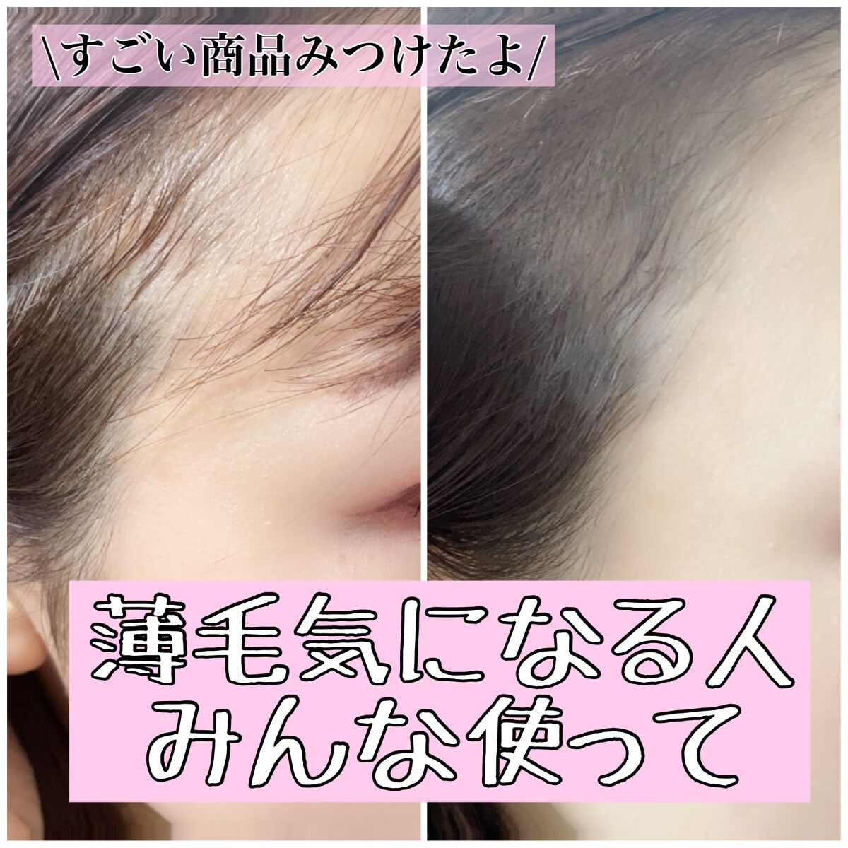 デコシャドウ by.F/Fujiko/シェーディングを使ったクチコミ（1枚目）