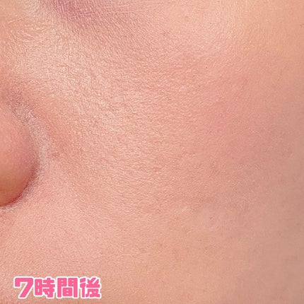 デューイーメッシュファンデーション/ASUNE /クッションファンデーションを使ったクチコミ(6枚目)