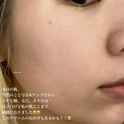 レッドブレミッシュ リペアスージングクリーム/Dr.G/フェイスクリームを使ったクチコミ(5枚目)