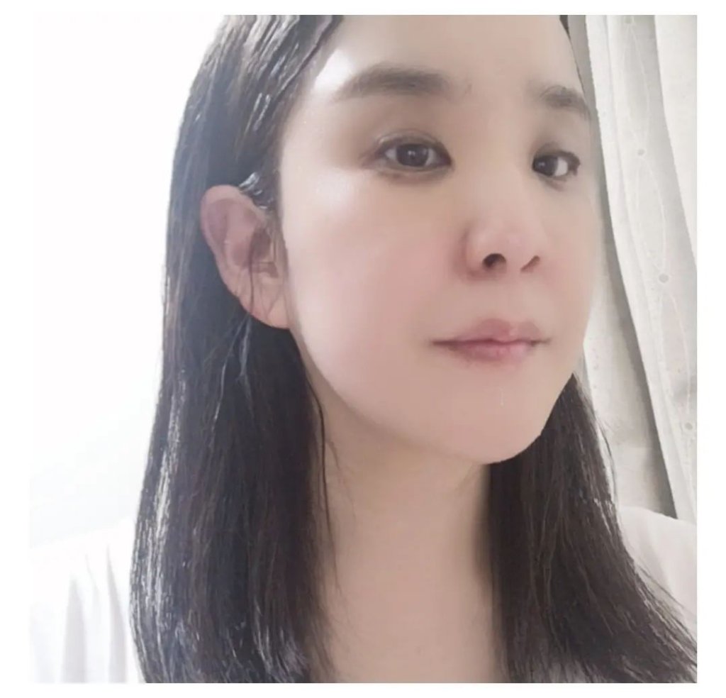 レチノモイスト バブルローション/ADICAL/化粧水を使ったクチコミ（3枚目）