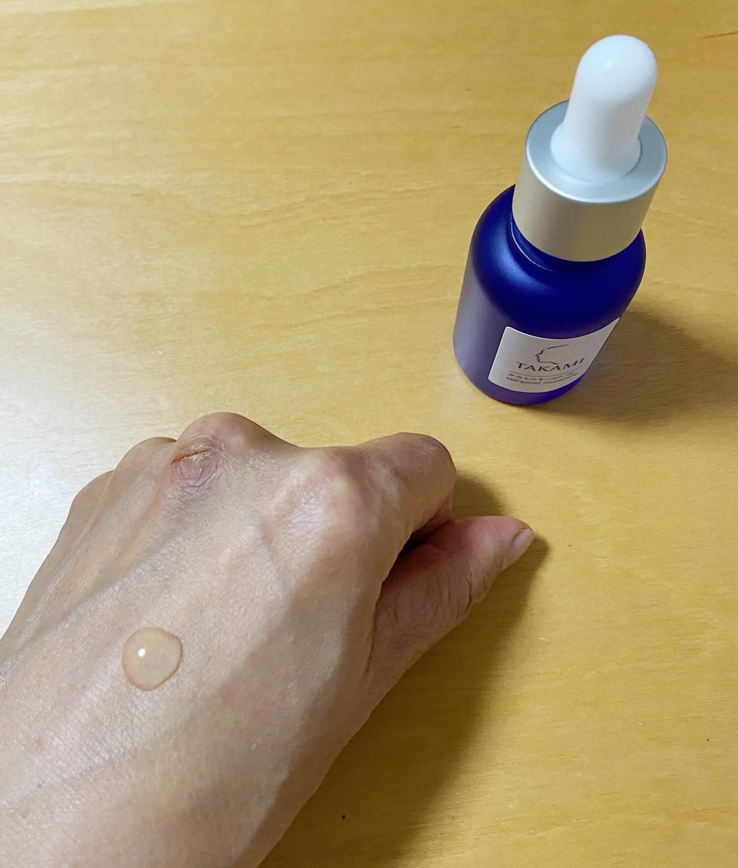 タカミスキンピール/タカミ/ブースター・導入液を使ったクチコミ（3枚目）