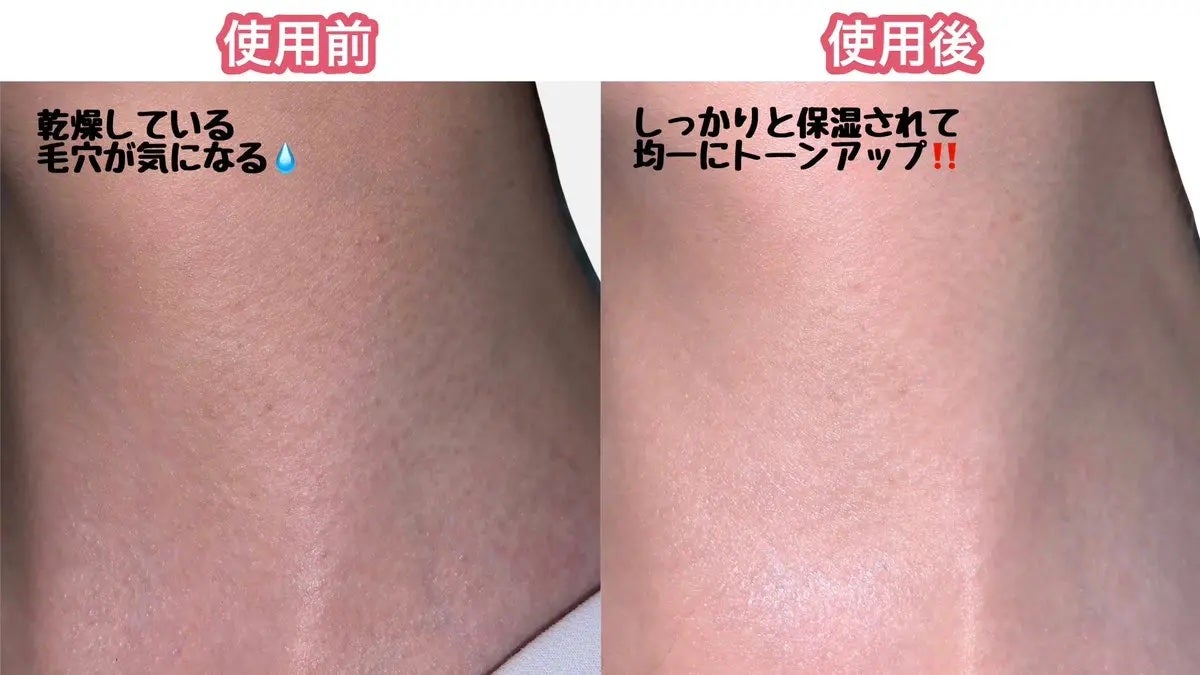 BnD ネックアイロン トーンアップ クリーム/BnD/ネック・デコルテケアを使ったクチコミ(3枚目)