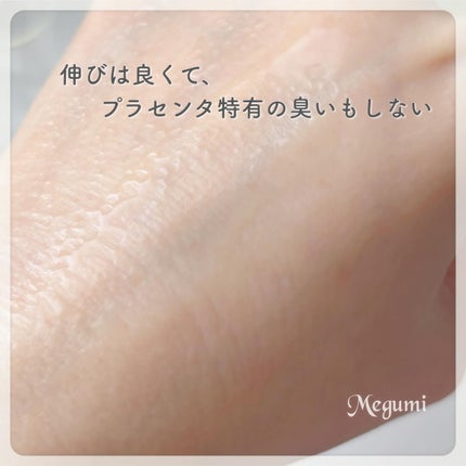P.P.エッセンス/Euphoric/美容液を使ったクチコミ(3枚目)
