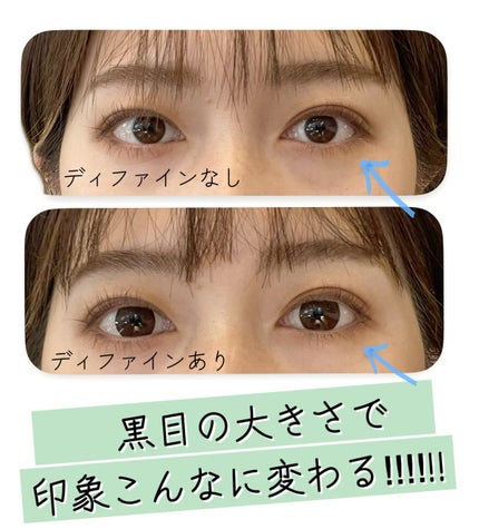 ワンデーアキュビュー®ディファイン®モイスト® ラディアント ブライト™/アキュビュー® ディファイン®/ワンデー(1DAY)カラコンの画像