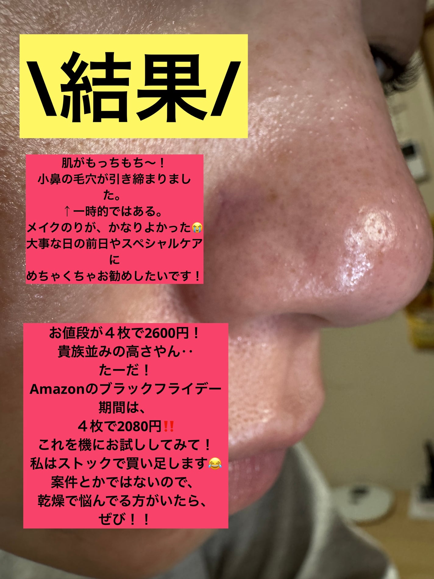 バイオコラーゲンリアルディープマスク/Biodance/シートマスク・パックを使ったクチコミ(5枚目)