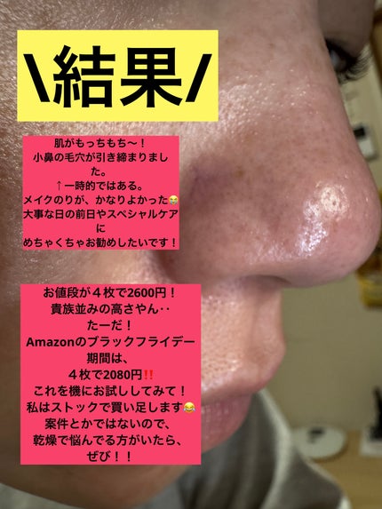 バイオコラーゲンリアルディープマスク/Biodance/シートマスク・パックを使ったクチコミ(5枚目)