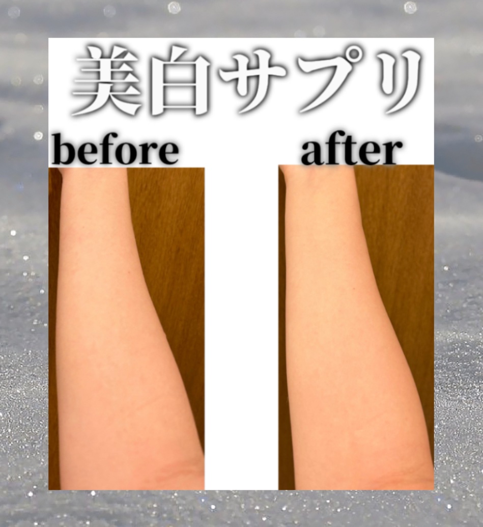 ビタミンC「タケダ」（医薬品）/タケダ/その他を使ったクチコミ（1枚目）