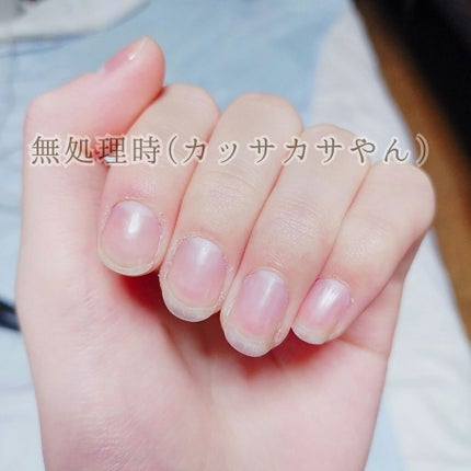 エテュセ クイックケアコート/ettusais/ネイルオイル・トリートメントを使ったクチコミ(3枚目)