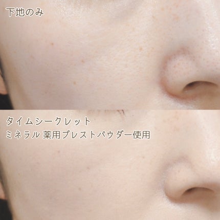 ミネラル 薬用プレストパウダー/TIME SECRET/プレストパウダーを使ったクチコミ(5枚目)
