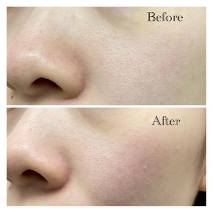 スーパーヴォルカニック ポア クレイマスク/innisfree/洗い流すパック・マスクを使ったクチコミ(4枚目)