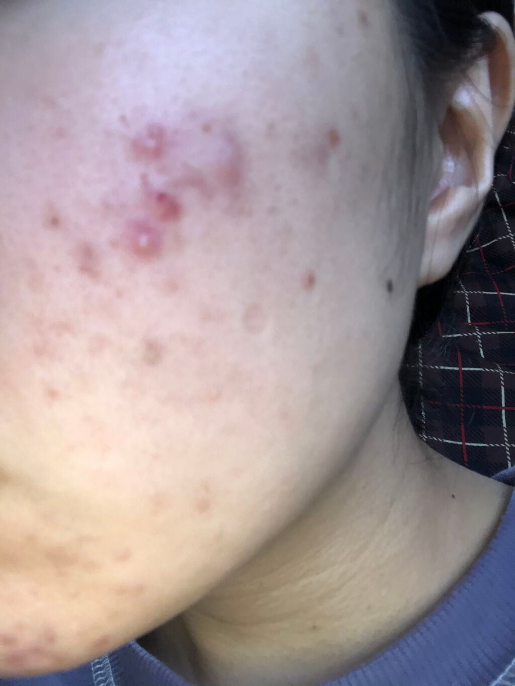 ホワイト洗顔クリーム/雪肌粋/洗顔フォームを使ったクチコミ(2枚目)